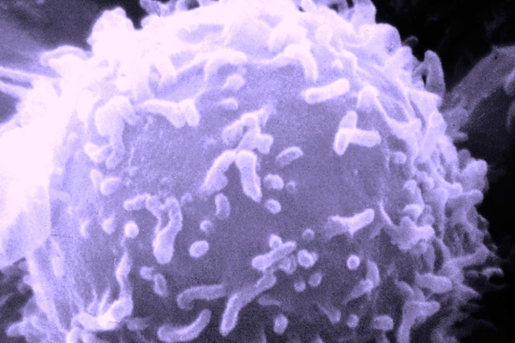 Лимфоцит человека. Снимок получен сканирующим электронным микроскопом. Фото: Национальный институт онкологии (США)